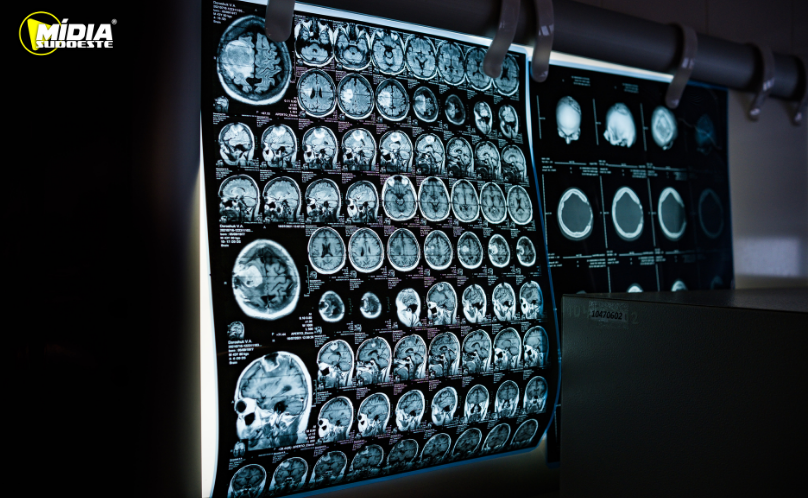 Brasil deve ter 781 mil novos casos de câncer por ano até 2028