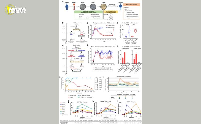 Estudo aponta avanço no tratamento do diabetes tipo II com uso de células-tronco