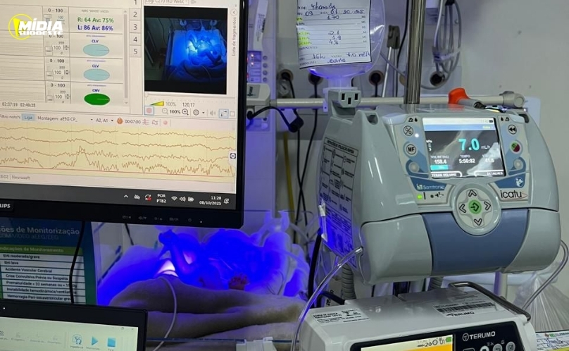 Hospital Regional terá tecnologia inédita para monitorar cérebro de recém-nascidos