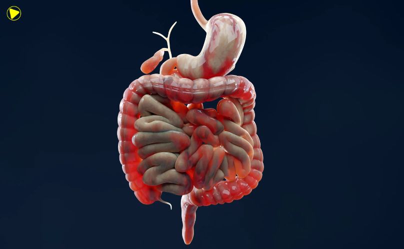 Doenças intestinais aumentam cinco vezes no Brasil