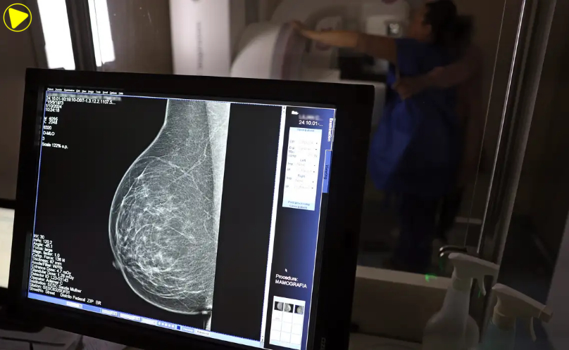 Planos de saúde podem negar mamografia digital por erro no pedido médico